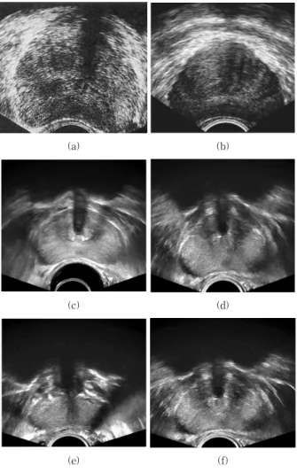 Fig. 2. TRUS images