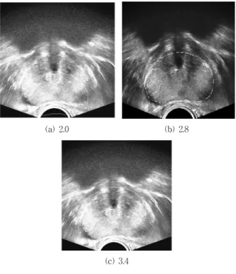 Fig. 6. Average prostate model