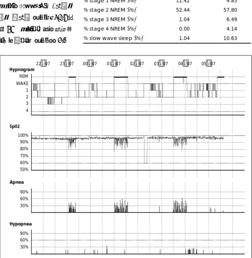 Table 1. A typical sleep structure of obstructive sleep  apnea  syndrome  is  observed  in  this  case