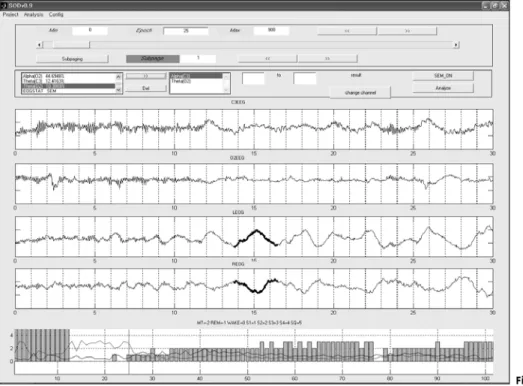 Fig. 3. SOD Version 0.9. 