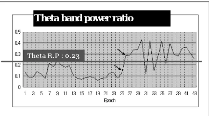 Fig. 5. Relative power of theta frequency band. Transition from wakefulness to stage 1 sleep is indicated by the line between two arrows