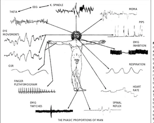그림 2는 REM수면 꿈의 생리적 증후와 국소적 뇌 기전을  활성화(activation=A),  입력(input=I),  변조(modulation= 