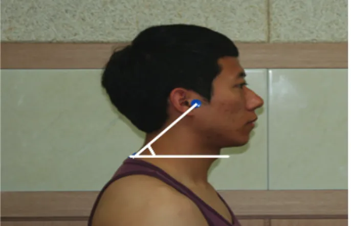 Fig 1. Craniovertebral angle measure method
