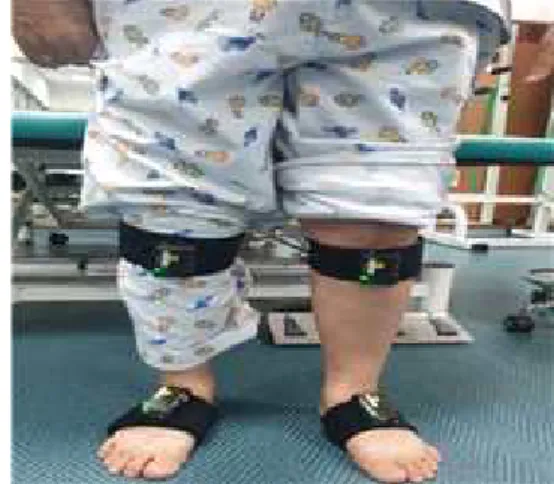 Figure  1.  Gait  analysis