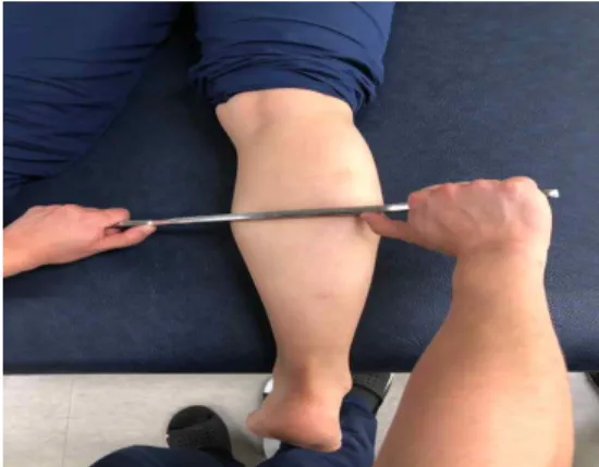 Figure  3.  Mobilization  with  Movement  for  improving  ankle  dorsi-flexion