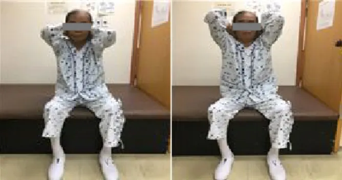 Figure 1. Thoracic self-mobilization(extension)