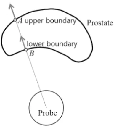 Fig. 3. Relation between the position of probe and the  shape of prostate