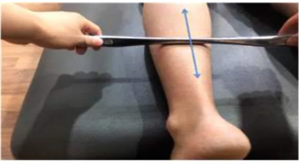 Figure  2.  Static  plantar  foot  pressure