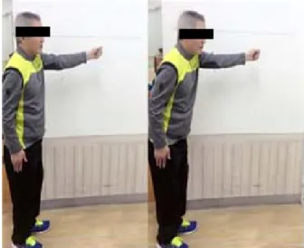 Figure 2. Scene of functional reach test   신경에  저항이  걸리기  전까지  무릎관절을  신전시켜  주면서  무릎관절을  굽힘과  함께  발목  관절을  배측  굴곡 시켜주었다