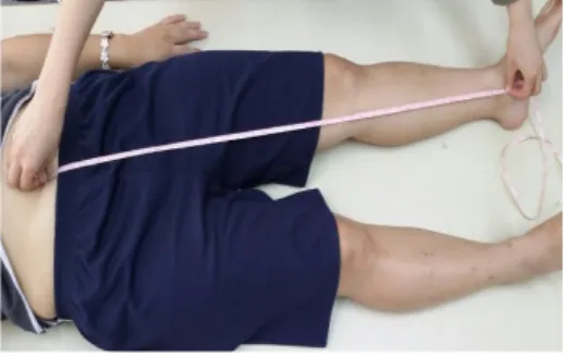 Fig 3. Measurement view for functional leg length discrepancy