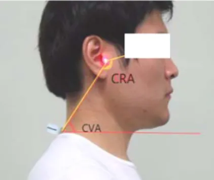 Fig 3. Forward head posture. CRA,  CVA measurement 3.  중재방법 운동군에서는  운동을  시작하기  전에  운동  프로그램에  대한  교육을  실시하였고,  직접적인  동작시범을  통하 여  운동에  대한  이해를  도왔다