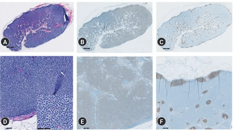 Fig. 3. Histopathologic and immunohistochemistry examination of the right prescapular lymph node