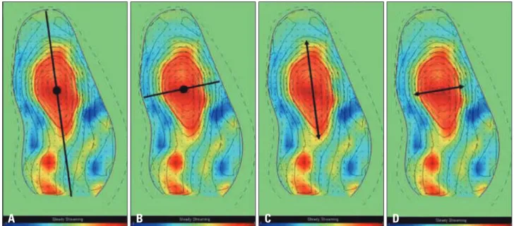 Fig. 4. Description of quantitative parameters of the vortex location and shape. Vortex depth (A, black line), vortex transverse position (B, black line),  vortex length (C, black arrow), and vortex width (D, black arrow)