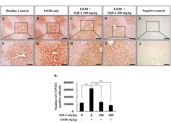 Fig. 3. Chronic alcohol consumption-induced CYP2E1 expression in mice. Immunohistochemical staining for CYP2E1 in the liver of (A, F) healthy control, (B, G) EtOH only, (C, H) EtOH+SQEA 100 mg/kg, (D, I) EtOH+SQEA 200 mg/kg, and (E, J) Negative control