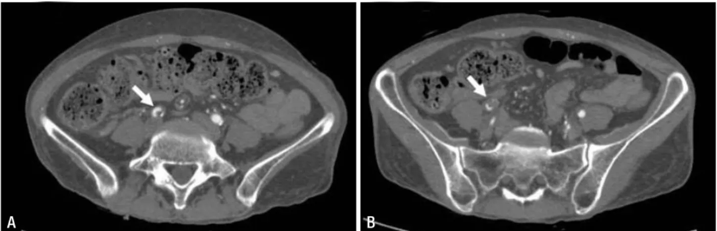 Table 2. Role of advanced echocardiographic techniques in stress-induced cardiomyopathy Clinical application