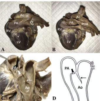 Fig. 2. Necropsy of the heart in a dog with intramural PDA. (A) The descending aorta and pulmonary trunk are dilated