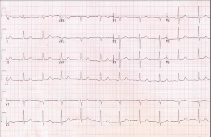 Fig. 1. Electrocardiogram shows normal sinus rhythm.