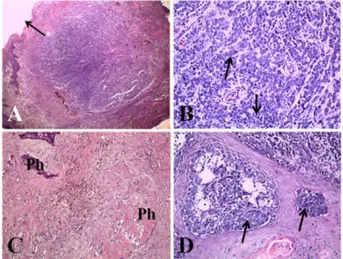Fig. 3. Histopathologic findings of nail bed malignant melano- melano-mas in dogs. (A) Note the severe epidermal ulceration (arrow) and dermal neoplastic mass in case one (H&amp;E stain, ×40)