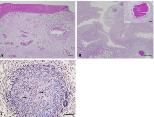 Fig. 3. Histopathology of the thoracic air sac and lungs. (A) A focal granuloma with a central necrotic area in a thickened air sac and necrotic materials attached to the air sac (H&amp;E, Scale bar = 50 µm)