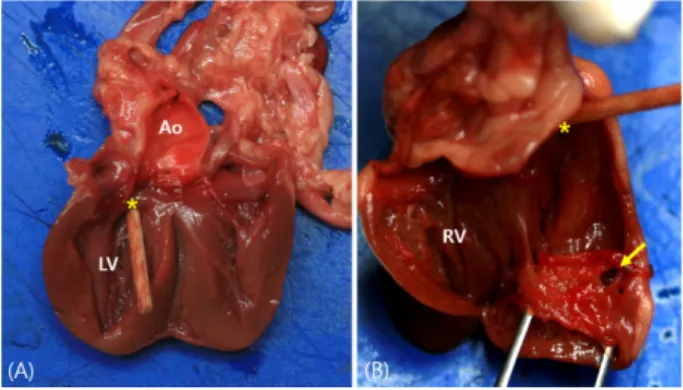 Fig. 2. Right long axis view (A) and right short axis (B) echo- echo-cardiographic views