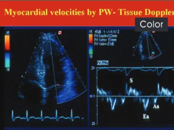 Fig. 1. Tissue Doppler signals from the lateral side of the mitral annulus.