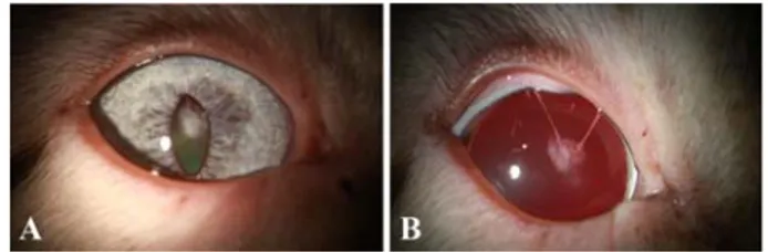 Fig. 1. Anterior capsular cataract due to persistent pupillary membranes (iris to lens) seen with diffuse illumination by  slit-lamp biomicroscopy in the right eye (A, before mydriasis; B, after mydriasis).