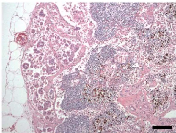 Fig. 4. Lymph node of dog. The subcapsular sinuses are dilated by clusters of neoplastic cells forming acini