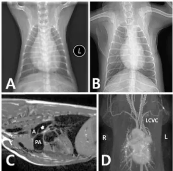 Fig. 1. (A) Thoracic radiography by barium contrast study shown enlargement of esophagus caused by obstruction