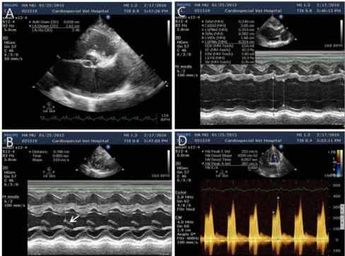 Fig. 3. The echocardiography of this case. (A) A right parasternal view of the aorta (Ao) and LA revealed severely enlarged LA (LA/