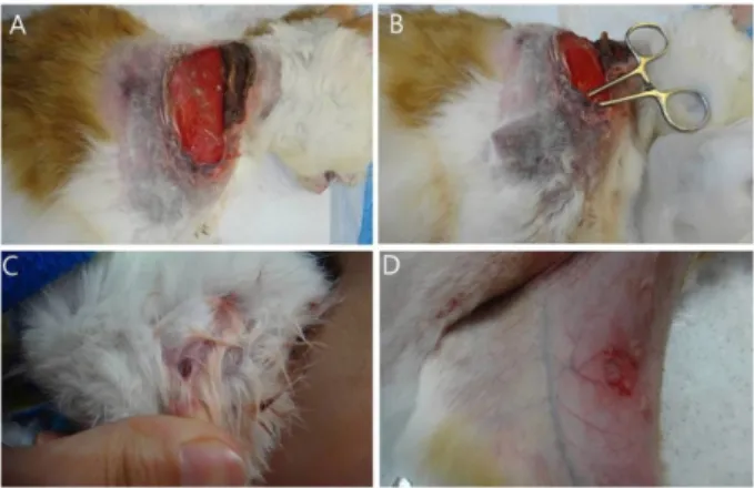 Fig. 1. Skin lesion of this case. (A and B) The skin lesion was consisted of 8.5 × 5.5 cm skin defects by ulcerative wound on the dorsal part of neck