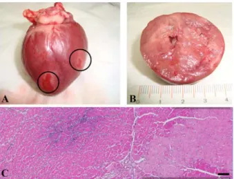 Fig. 3. Gross and histopathological findings of this case. (A) Grossly, heart was enlarged
