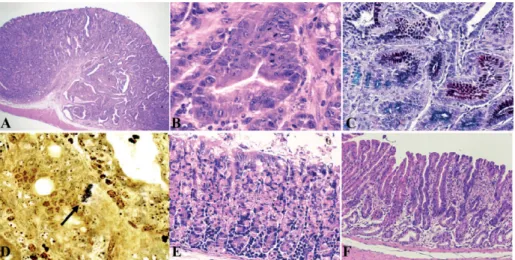 Table 3. Scoring of histologic grade of gastritis according to the updated Sydney system