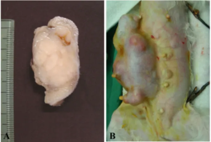 Fig. 2. Tumor cells were elongate shape or polyhedral pattern in benign peripheral nerve sheath tumor (A) and malignant  periph-eral nerve sheath tumor (B)