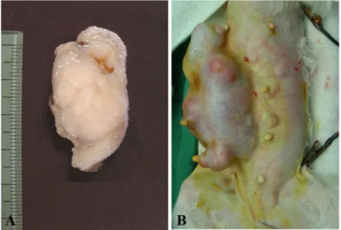 Fig. 2. Tumor cells were elongate shape or polyhedral pattern in benign peripheral nerve sheath tumor (A) and malignant  periph-eral nerve sheath tumor (B)