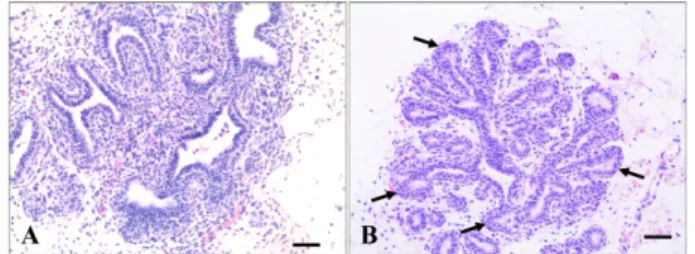 Fig. 1. Histological features of pre-pubertal (A) and pubertal mammary glands (B) of dairy cow