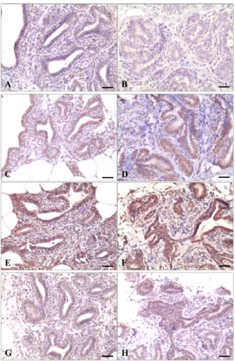 Fig. 3. Immunostaining of Ki-67 in the pre-pubertal (A) and pubertal mammary glands (B) of dairy cow