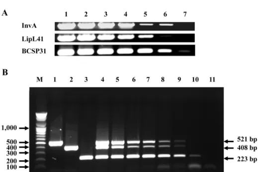 Fig. 1. Sensitivity of single PCR for Salmonella,  Leptospira and Brucella target genes (A) and the multiplex PCR for simultaneous amplification of  all bacterial target DNA (B)