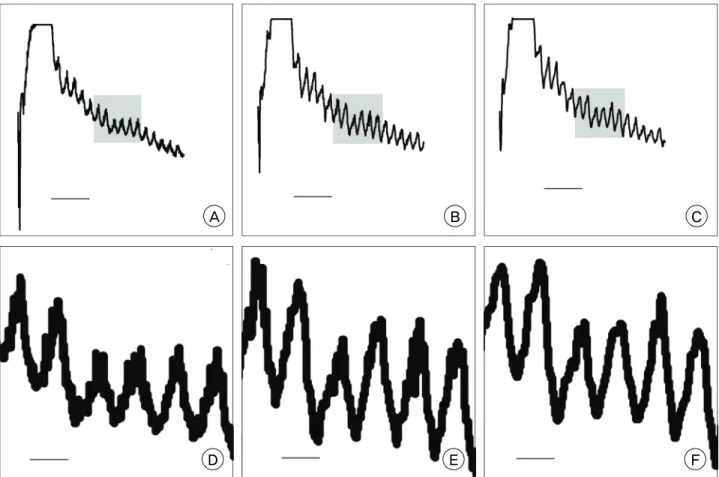 Fig. 1. Comparison of graph details according to sampling interval. A, D are made in 0.1 seconds; B, E in 0.2 seconds; C, F in 0.4  seconds