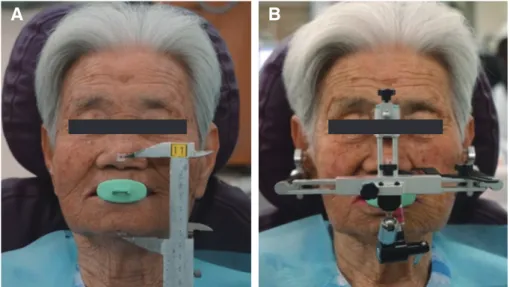 Fig. 10. Articulator mounting.