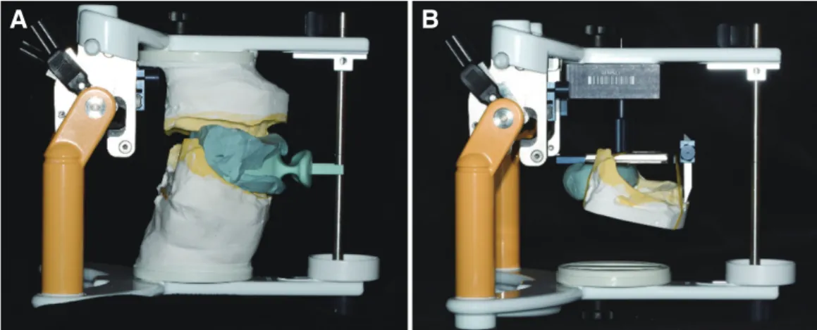 Fig. 5. Mounting the diagnostic cast with Centric tray and Horizontal guide.