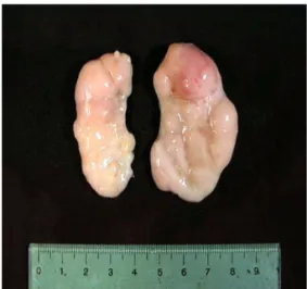 Fig. 1.  Lymph node. Inguinal lymph nodes infected with porcine circovirus type 2 and porcine parvovirus were severely enlarged.