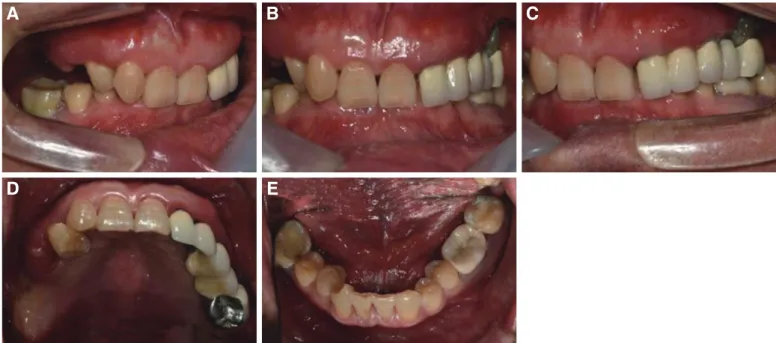 Fig. 2. Initial panoramic radiograph.