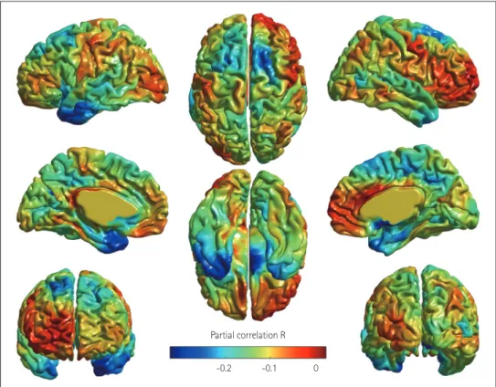 Fig. 2. Regions showing significant partial correlations between Mini Nutritional Assessment score and regional cortical thickness in the left temporal  pole after adjustment for covariates