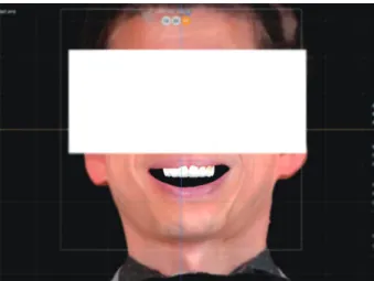 Fig. 6. Delivery of definitive restorations.