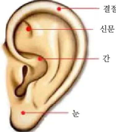Figure 1. Points of auricular acupressure therapy.