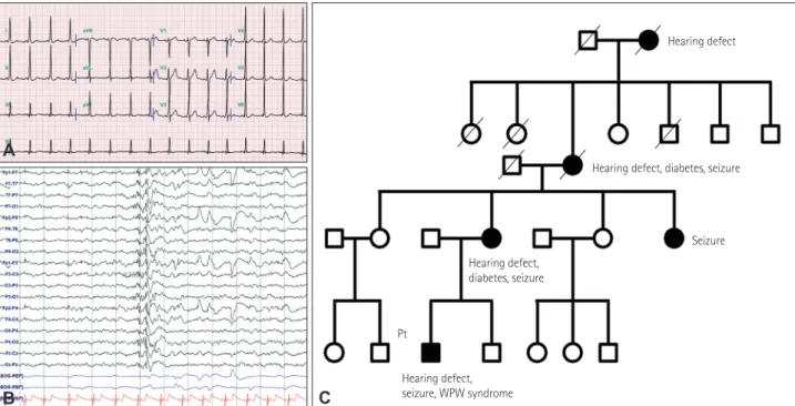 Fig. 1. A: Electrocardiography shows a short PR interval (96 msec) and QRS-complex widening (114 msec) with a delta wave