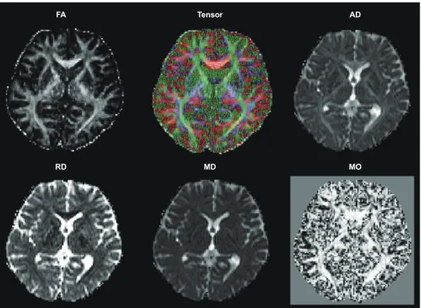 Fig. 1. DTI scalar images derived from diffusion-tensor images with 20 gradient directions