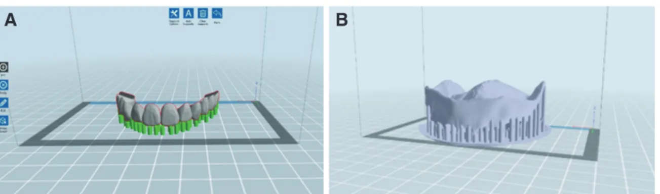 Fig. 7. Support structures using 3D printing software (Flash DLPrint, FLASHFORGE, California, USA)