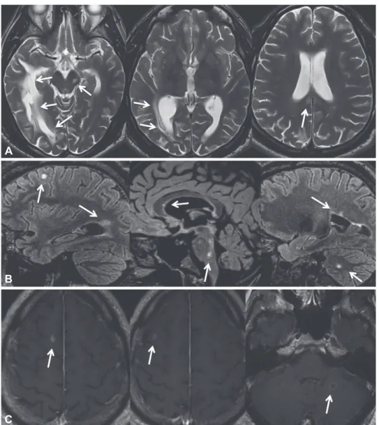 Fig. 1. The patient’s arms, hands, and fingers were covered with hy- hy-perkeratotic skin lesions consistent with lichen simplex chronicus.