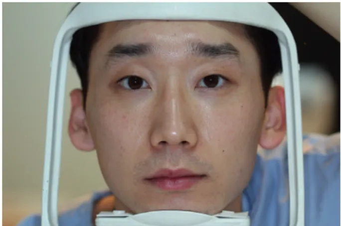 Fig. 1. A fixation support for use when taking gaze photographs. The  patient’s head could be fixed in a standardized stationary position  with the chin and forehead resting on the support.